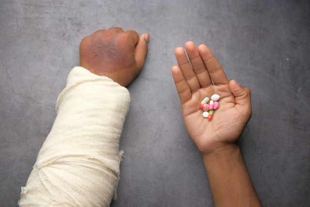 injured hand with bandage